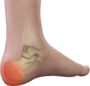 pain in heel and back of foot